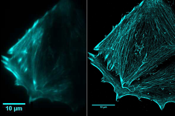 1-4-Super-Resolution Microscopy