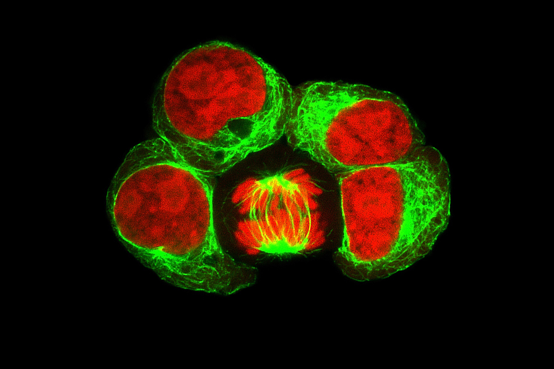 Leukosis cell line labeled with fluorescent dyes. One cell in division