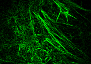 SIM Microscopy imaging