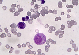 Blood Cell imaging-TrueChrome HDMI Camera