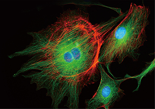 Low Light Cell Fluorescence Imaging – Dhyana 400DC sCMOS Camera