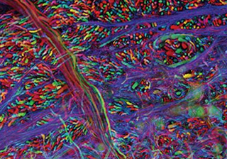 Microscopic imaging technology—Micro dark field imaging
