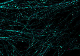 STORM Super Resolution Imaging.