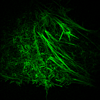Super Resolution