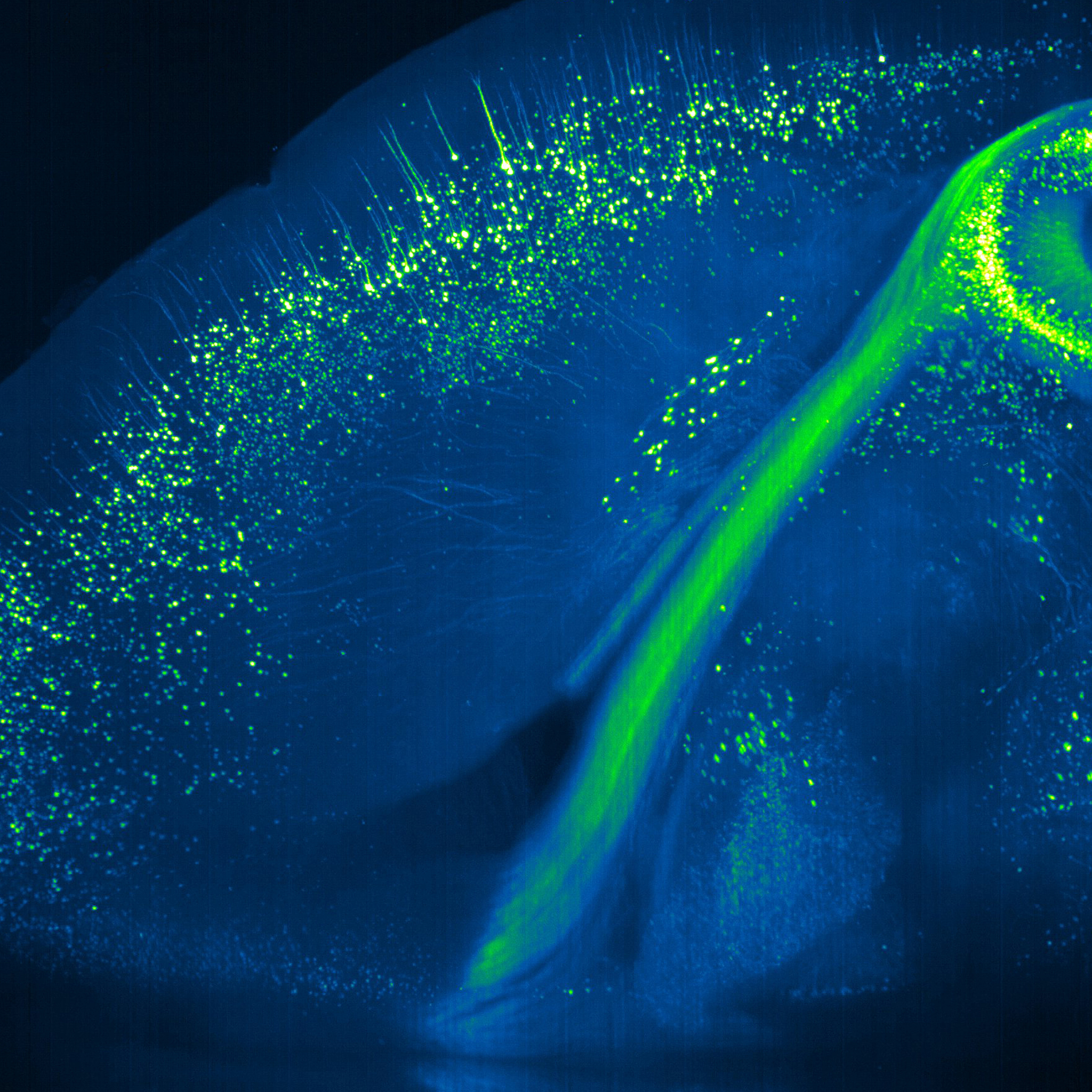 Light-sheet microscopy