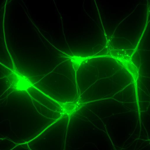 Voltage Sensitive Imaging