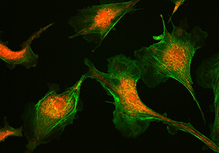 BPAEC Cell Fluorescence Mirocscopy Imaging – MIchrome CMOS Camera