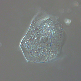 DIC microscoy