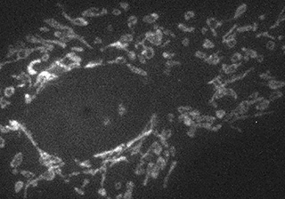 TIRF Microscopy Imaging