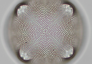 Algae cell DIC Microscopy imaging