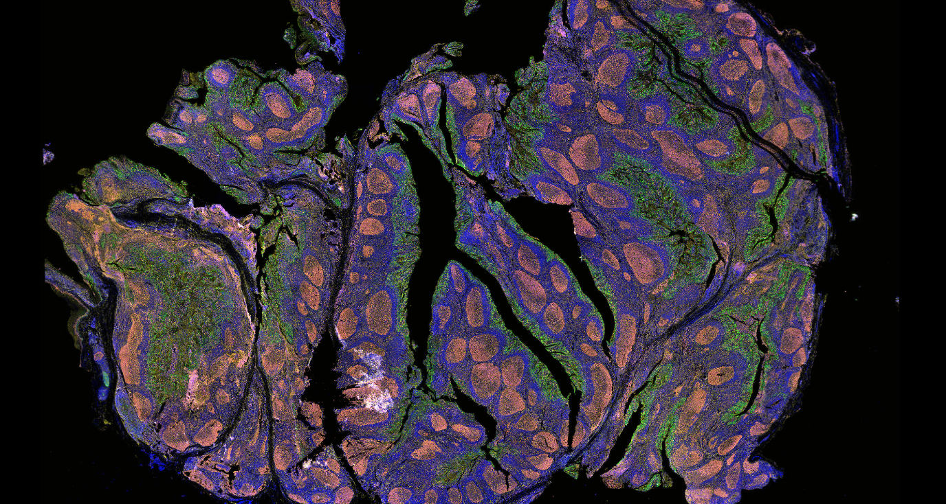 fluorescence microscopy sample