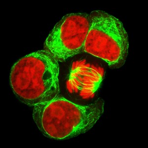 Leukosis cell line labeled with fluorescent dyes. One cell in division